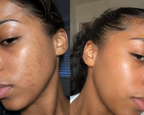Turmeric Glow & Radiance Skincare Bundle | Complete 5-Piece Face & Body Collection