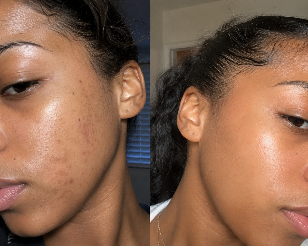 Turmeric Glow & Radiance Skincare Bundle | Complete 5-Piece Face & Body Collection