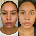 Turmeric Glow & Radiance Skincare Bundle | Complete 5-Piece Face & Body Collection
