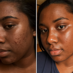 Turmeric Glow & Radiance Skincare Bundle | Complete 5-Piece Face & Body Collection